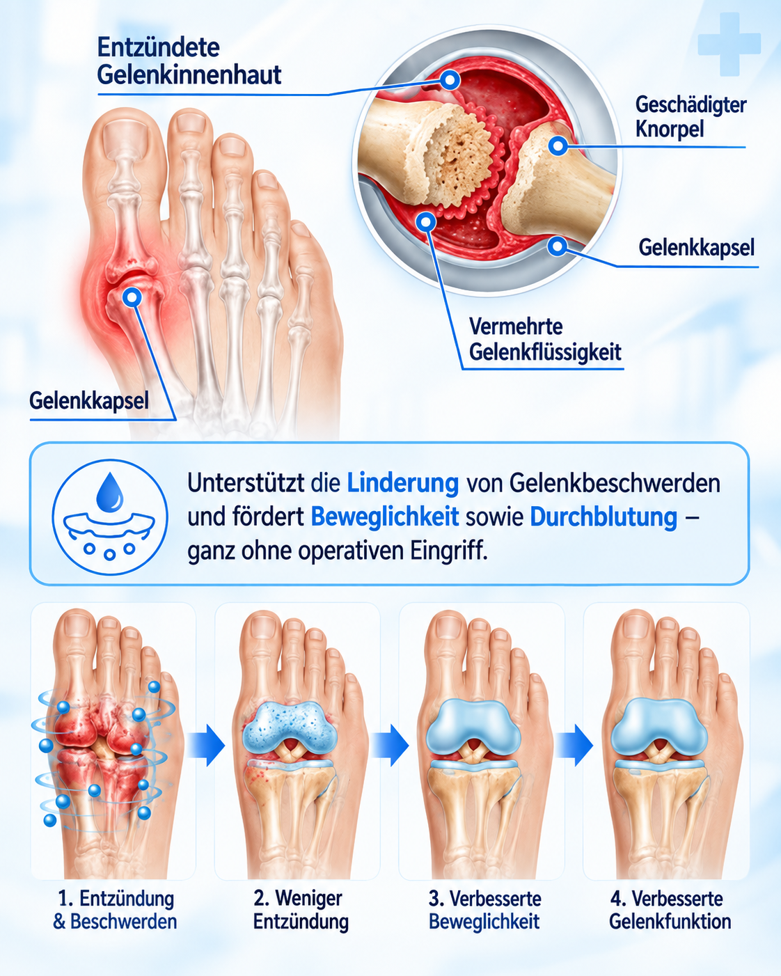 🏅 Natravor® Botanisches Komfort-Pflaster bei Hallux valgus 👠（ Flexible Fußpflege + pflanzlich inspirierte Komfortformel）a