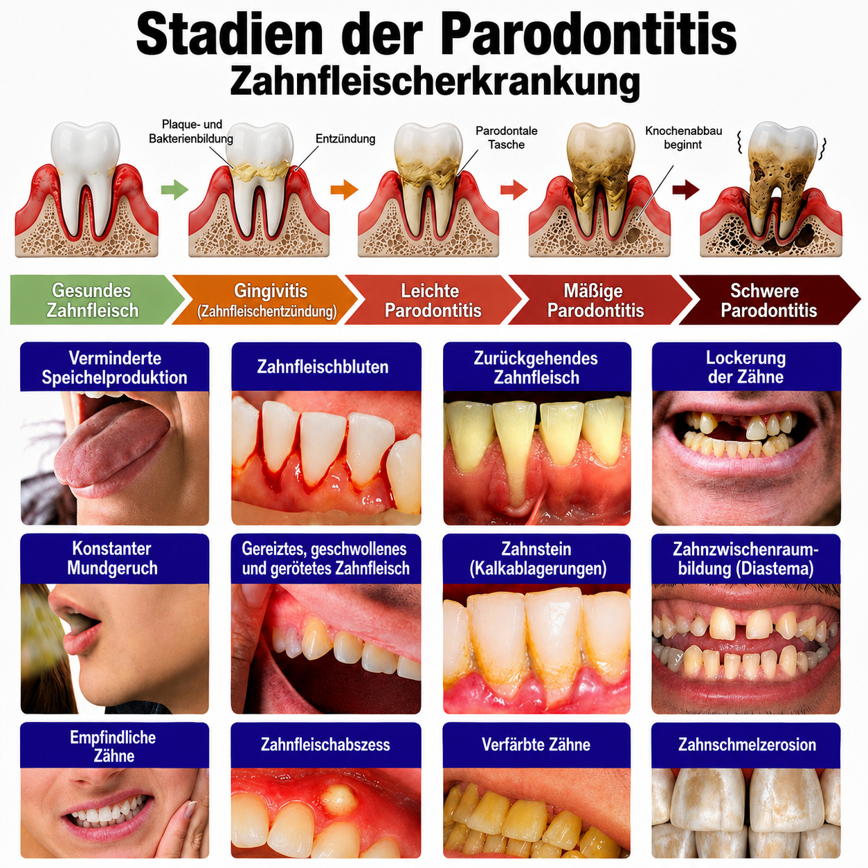 🇩🇪 𝐍𝐚𝐭𝐫𝐚𝐯𝐨𝐫® VioCore Zahnpasta zur Behandlung von Zahnfleischentzündungen und Parodontitis mit Bienengift
