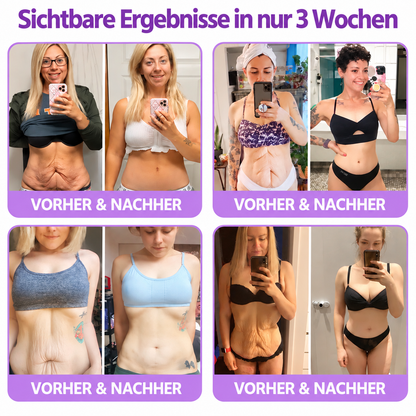 Natravor®🎗️ PDRN Multi-Peptid Straffende Körpercreme ｜ Anti-Aging Pflege, Feuchtigkeit, Straffung & Lifting für ein glatteres, ebenmäßigeres Hautbild｜a