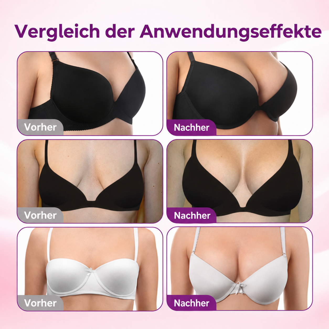 ✅𝐍𝐚𝐭𝐫𝐚𝐯𝐨𝐫® Fortschrittliches Nano-Mikronadel-Pflaster zur Brustkonturierung & Pflege 🍅