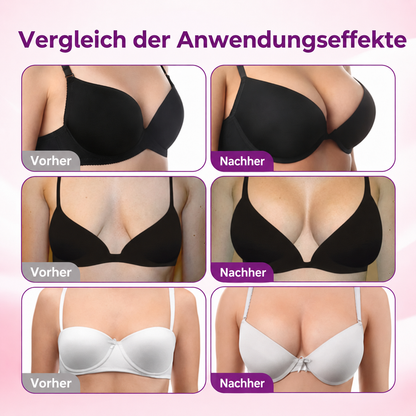 ✅𝐍𝐚𝐭𝐫𝐚𝐯𝐨𝐫® Fortschrittliches Nano-Mikronadel-Pflaster zur Brustkonturierung & Pflege 🍅