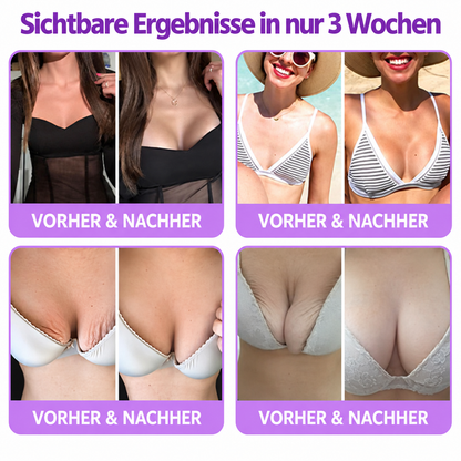 Natravor®🎗️ PDRN Multi-Peptid Straffende Körpercreme ｜ Anti-Aging Pflege, Feuchtigkeit, Straffung & Lifting für ein glatteres, ebenmäßigeres Hautbild｜a