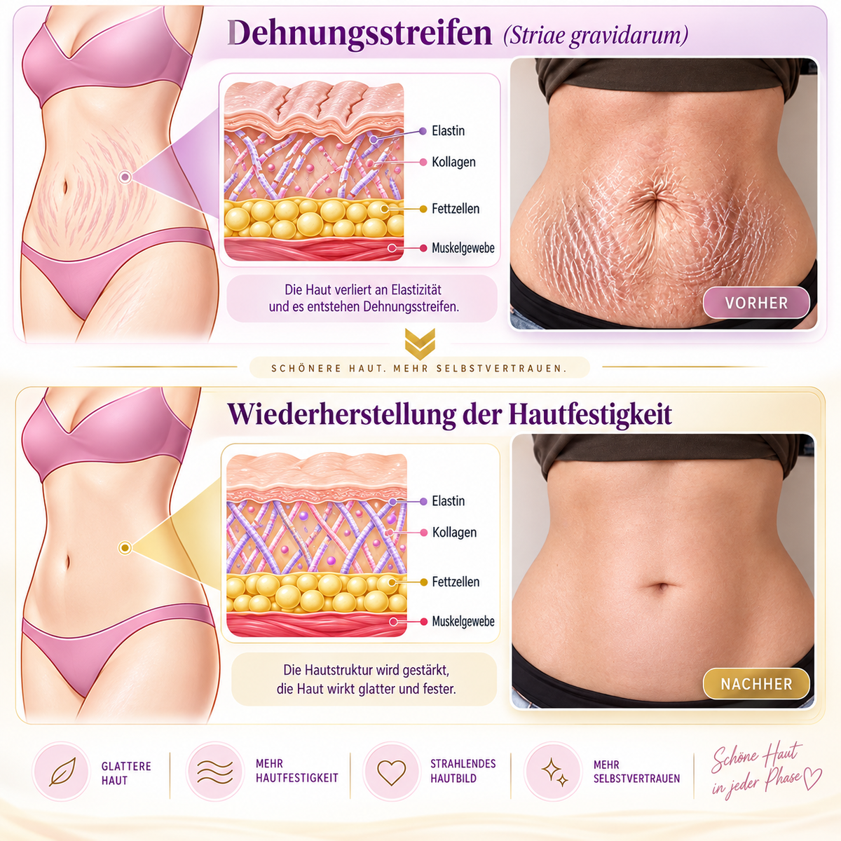 Natravor®🎗️ PDRN Multi-Peptid Straffende Körpercreme ｜ Anti-Aging Pflege, Feuchtigkeit, Straffung & Lifting für ein glatteres, ebenmäßigeres Hautbild｜a