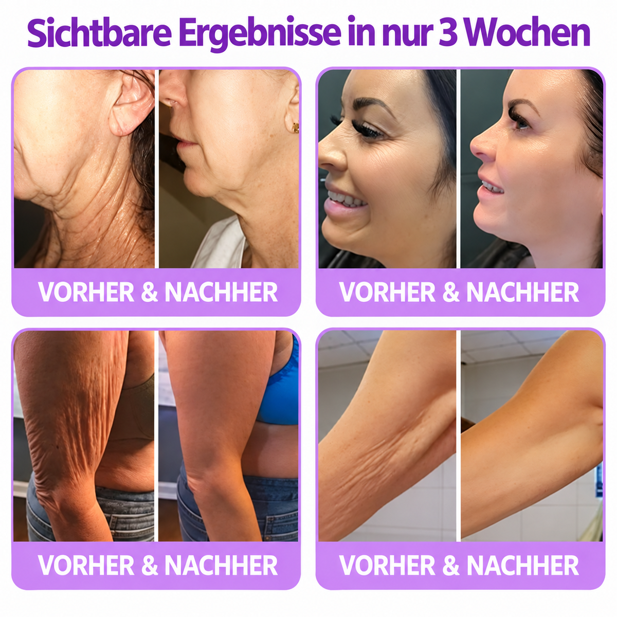 Natravor®🎗️ PDRN Multi-Peptid Straffende Körpercreme ｜ Anti-Aging Pflege, Feuchtigkeit, Straffung & Lifting für ein glatteres, ebenmäßigeres Hautbild｜a