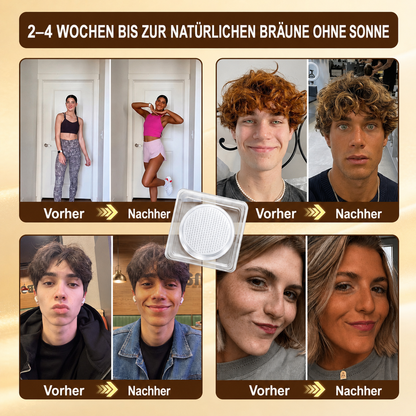⭐ 𝗡𝗮𝘁𝗿𝗮𝘃𝗼𝗿® Mikronadel-Bräunungspflaster: Natürlicher Bronze-Glow ohne UV & DHA