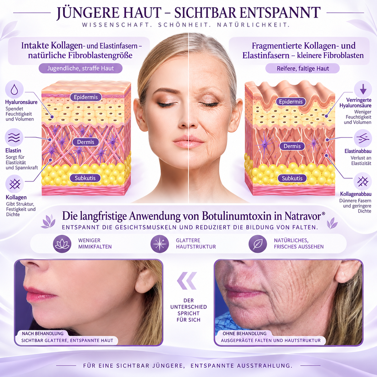 Natravor®🎗️ PDRN Multi-Peptid Straffende Körpercreme ｜ Anti-Aging Pflege, Feuchtigkeit, Straffung & Lifting für ein glatteres, ebenmäßigeres Hautbild｜a