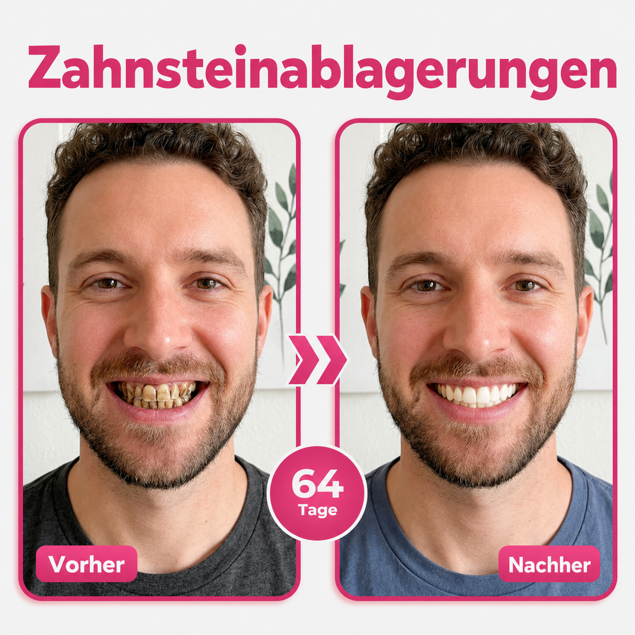 🪥Natravor® Thismile NH-10 Zahnpasta-Serum für Zahnschmelz und Zahnfleisch – Advanced Therapy
