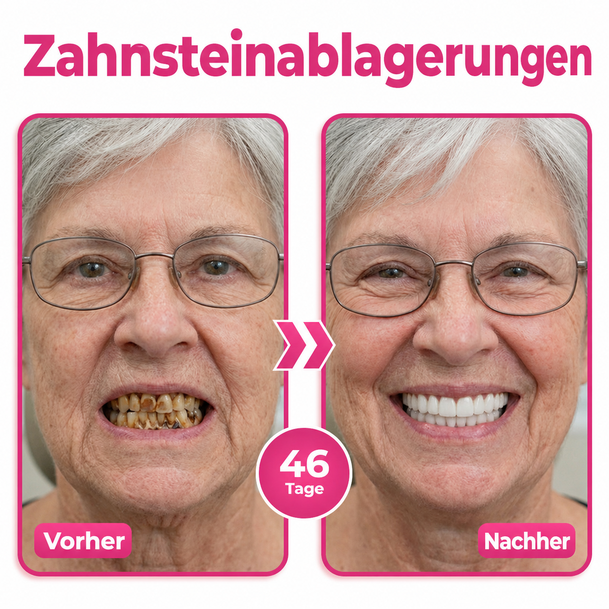 🪥Natravor® Thismile NH-10 Zahnpasta-Serum für Zahnschmelz und Zahnfleisch – Advanced Therapy