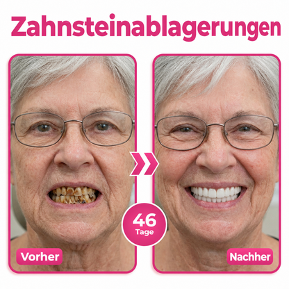 🪥Natravor® Thismile NH-10 Zahnpasta-Serum für Zahnschmelz und Zahnfleisch – Advanced Therapy