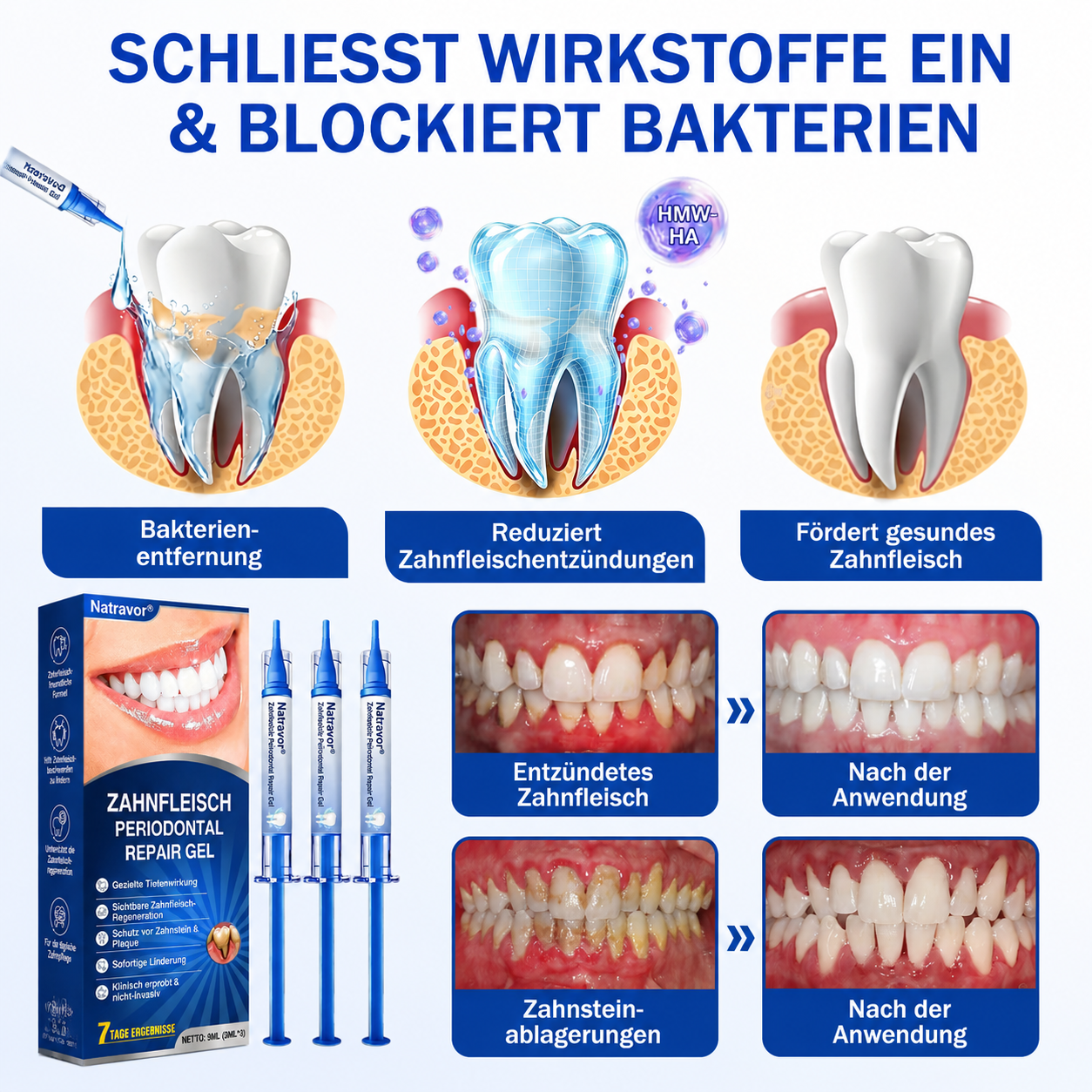 🇩🇪🏅🦷🛡️𝐍𝐚𝐭𝐫𝐚𝐯𝐨𝐫® Zahnfleischpflege- & Parodontalgel