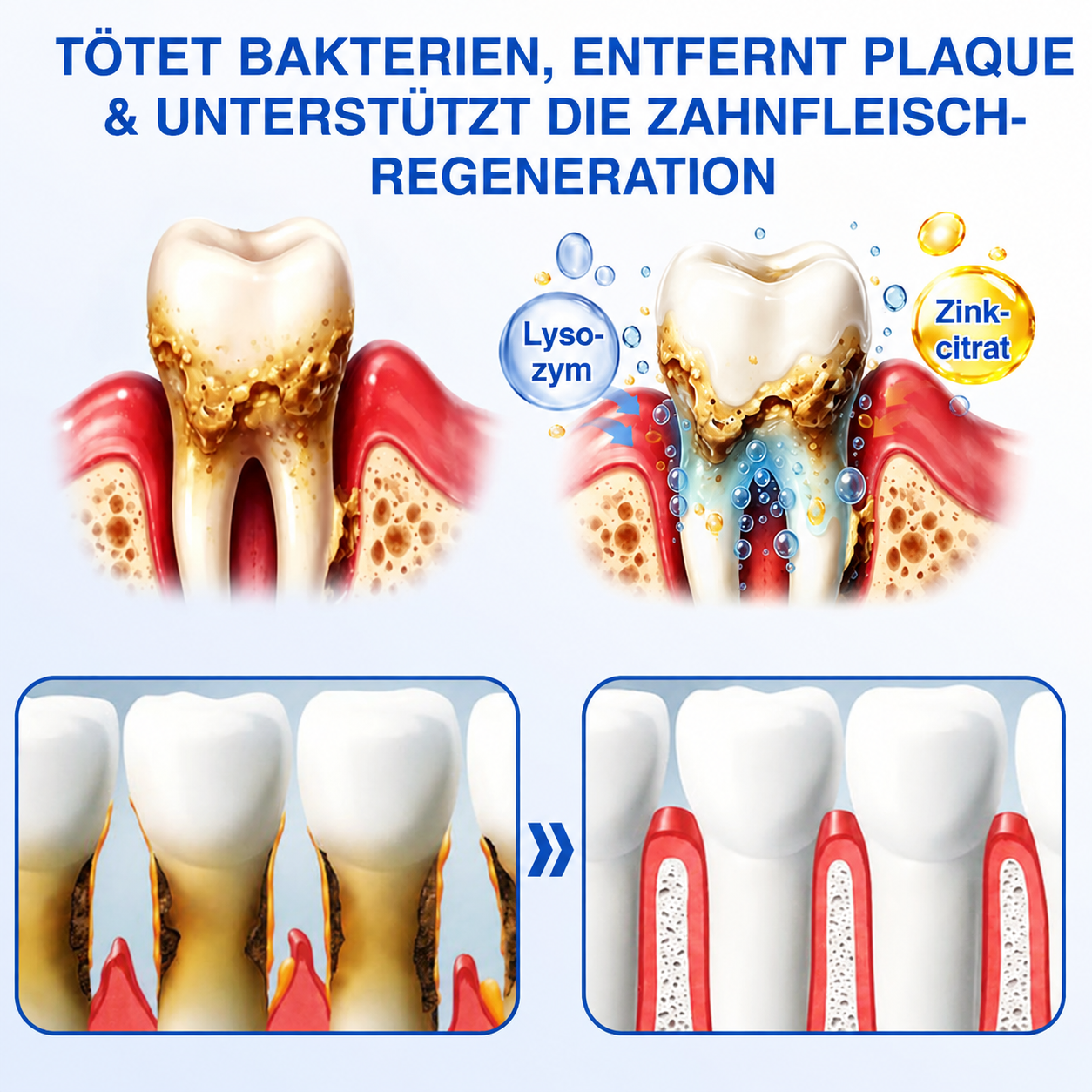 🇩🇪🏅🦷🛡️𝐍𝐚𝐭𝐫𝐚𝐯𝐨𝐫® Zahnfleischpflege- & Parodontalgel