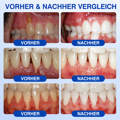 🇩🇪🏅🦷🛡️𝐍𝐚𝐭𝐫𝐚𝐯𝐨𝐫® Zahnfleischpflege- & Parodontalgel