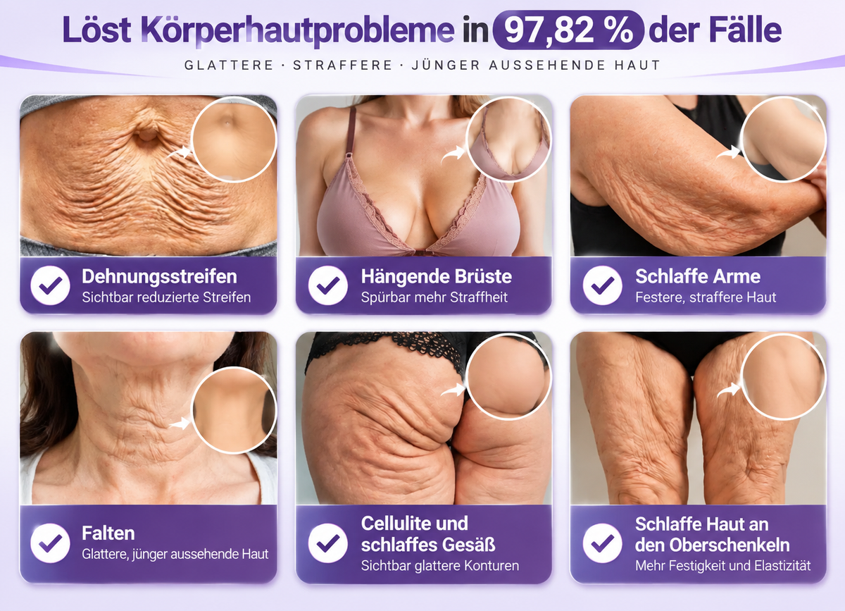 Natravor®🎗️ PDRN Multi-Peptid Straffende Körpercreme ｜ Anti-Aging Pflege, Feuchtigkeit, Straffung & Lifting für ein glatteres, ebenmäßigeres Hautbild｜a