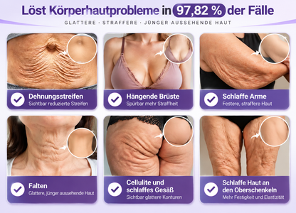Natravor®🎗️ PDRN Multi-Peptid Straffende Körpercreme ｜ Anti-Aging Pflege, Feuchtigkeit, Straffung & Lifting für ein glatteres, ebenmäßigeres Hautbild｜a