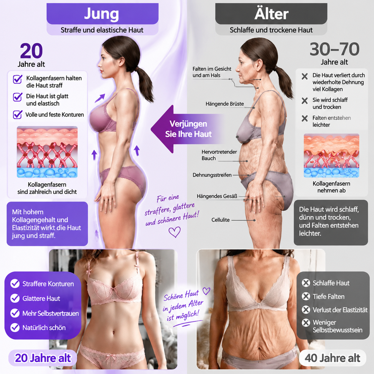 Natravor®🎗️ PDRN Multi-Peptid Straffende Körpercreme ｜ Anti-Aging Pflege, Feuchtigkeit, Straffung & Lifting für ein glatteres, ebenmäßigeres Hautbild｜a