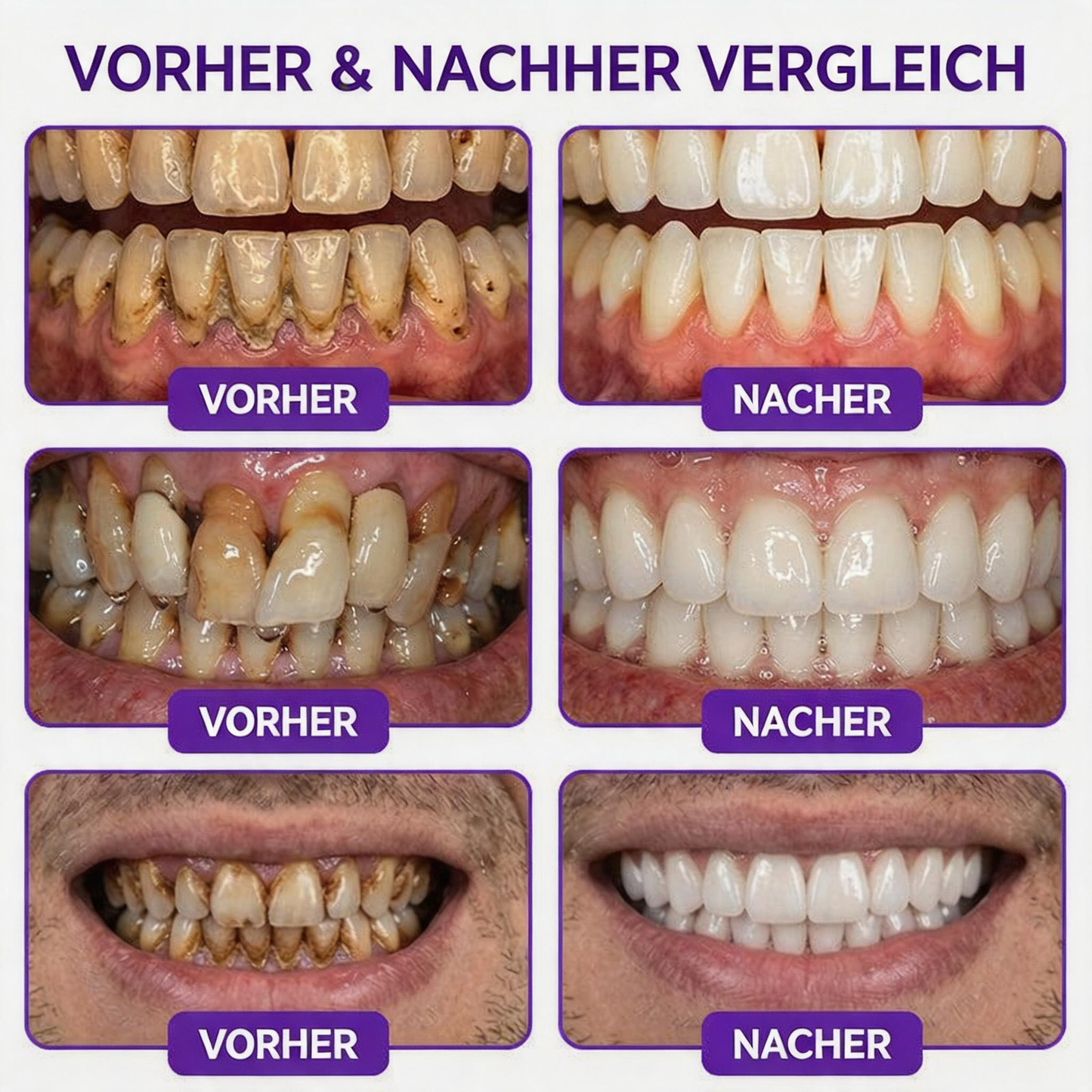 🇩🇪 𝐍𝐚𝐭𝐫𝐚𝐯𝐨𝐫® VioCore Zahnpasta zur Behandlung von Zahnfleischentzündungen und Parodontitis mit Bienengift